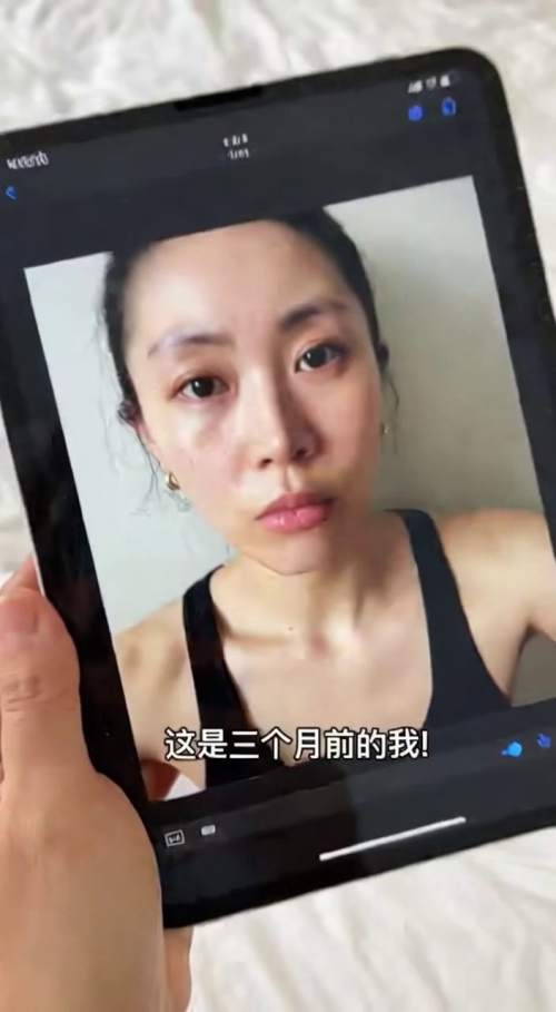 38岁女士三个月「全维焕能瓶」体验